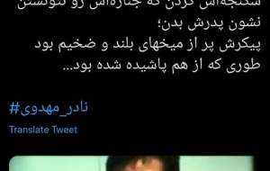 شهیدی با بدن پر از میخ‌های بلند +عکس
